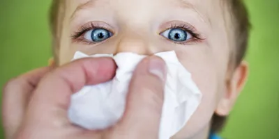 Nosebleeds Causes: Why They Happen and How to Prevent Them