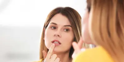 Woman treating a cold sore in front of mirror