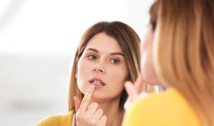 Woman treating a cold sore in front of mirror